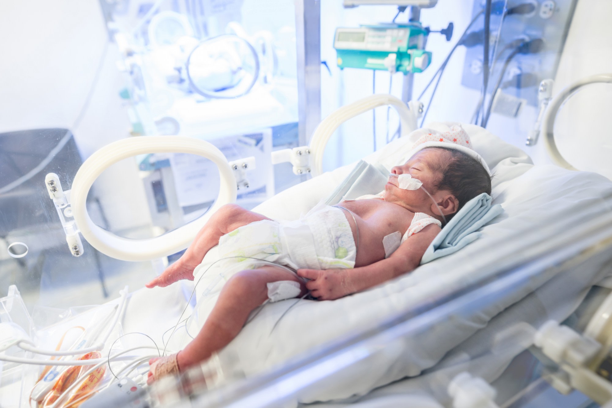 Baby on an incubator