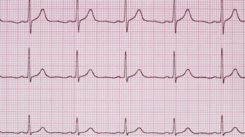 Person assisting an unconscious man lying on the floor, demonstrating the recovery position for first aid.