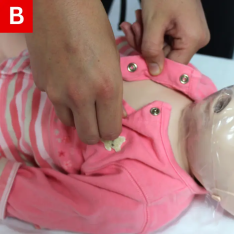 BLS Figure 12 B Expose the person’s chest