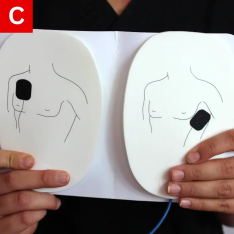 BLS Figure 8 C Open the AED pads