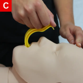 OPA is placed in the mouth