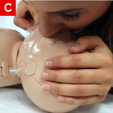 BLS Figure 14 C Gently blow into the infant’s nose and mouth for one second