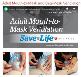 Instructional images and video about adult mouth-to-mask and bag-mask ventilation techniques for basic life support, showing hands demonstrating proper mask placement on a mannequin.