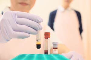 blood-samples-examined-by-medical-assistant