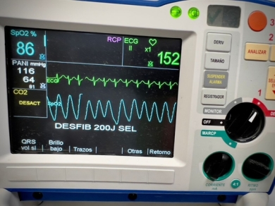 Close-up of a medical defibrillator monitor displaying vital signs including SpO2, heart rate at 152 bpm, blood pressure, and ECG waveforms, with defibrillation option selected.