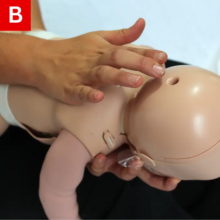 CPR-Figure-28-B give five back slaps between the infant’s shoulder blades