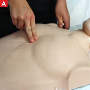 Adult CPR Chest Compressions