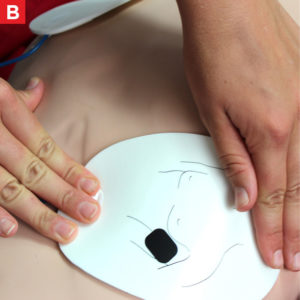 AED - Adults B