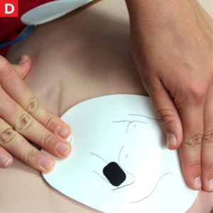 AED - Children D