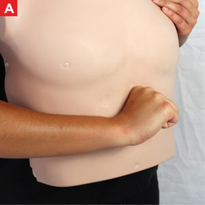 Relief of Choking - Heimlich Maneuver - A