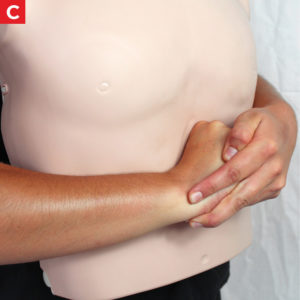 Relief of Choking - Heimlich Maneuver - C