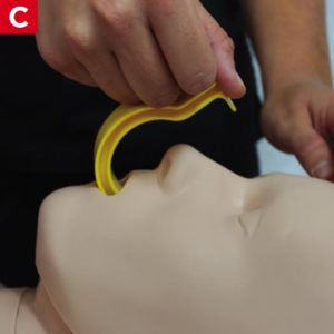 ACLS Airway Management OPA Mouth insertion