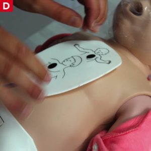 BLS AED Children Infants - Place Pads