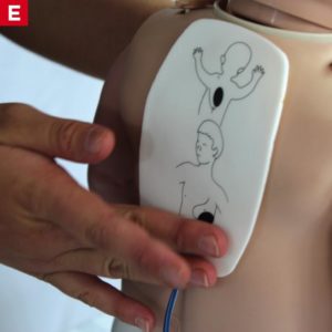 BLS AED Children Infants - Place Pads