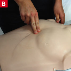 BLS Adult CPR - Placement