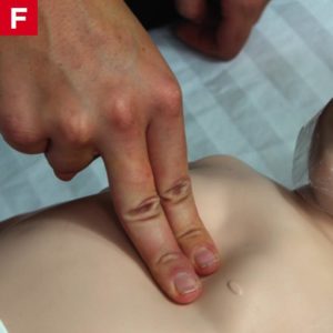 BLS Infant CPR -