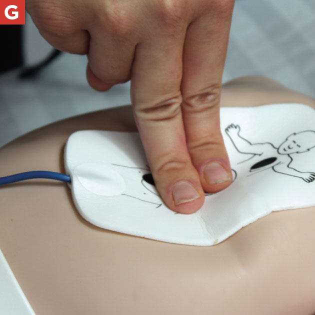 PALS AED Children Infants - Compressions