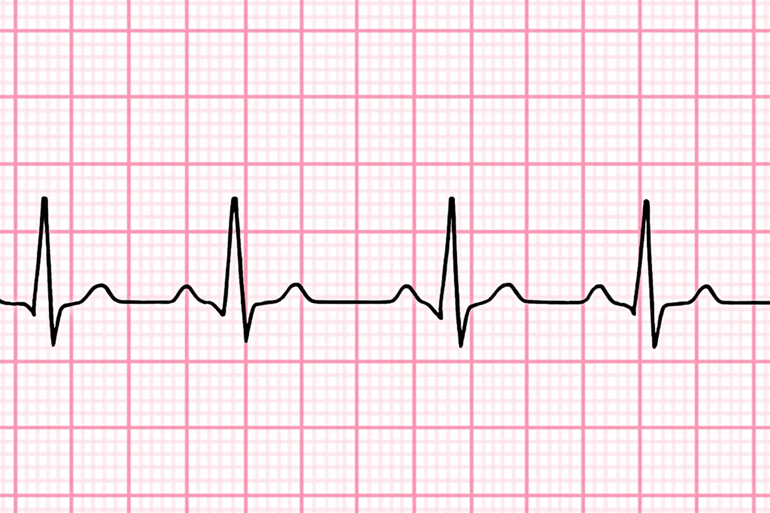 ACLS-Figure-38 Figure 38