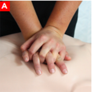 ADULT BAG-MASK VENTILATION-a