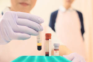 blood-samples-examined-by-medical-assistant