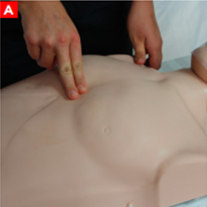 cpr_figure14a
