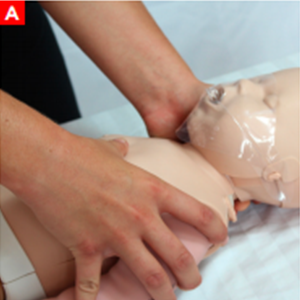 cpr_figure25a