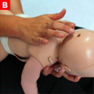 cpr_figure28b
