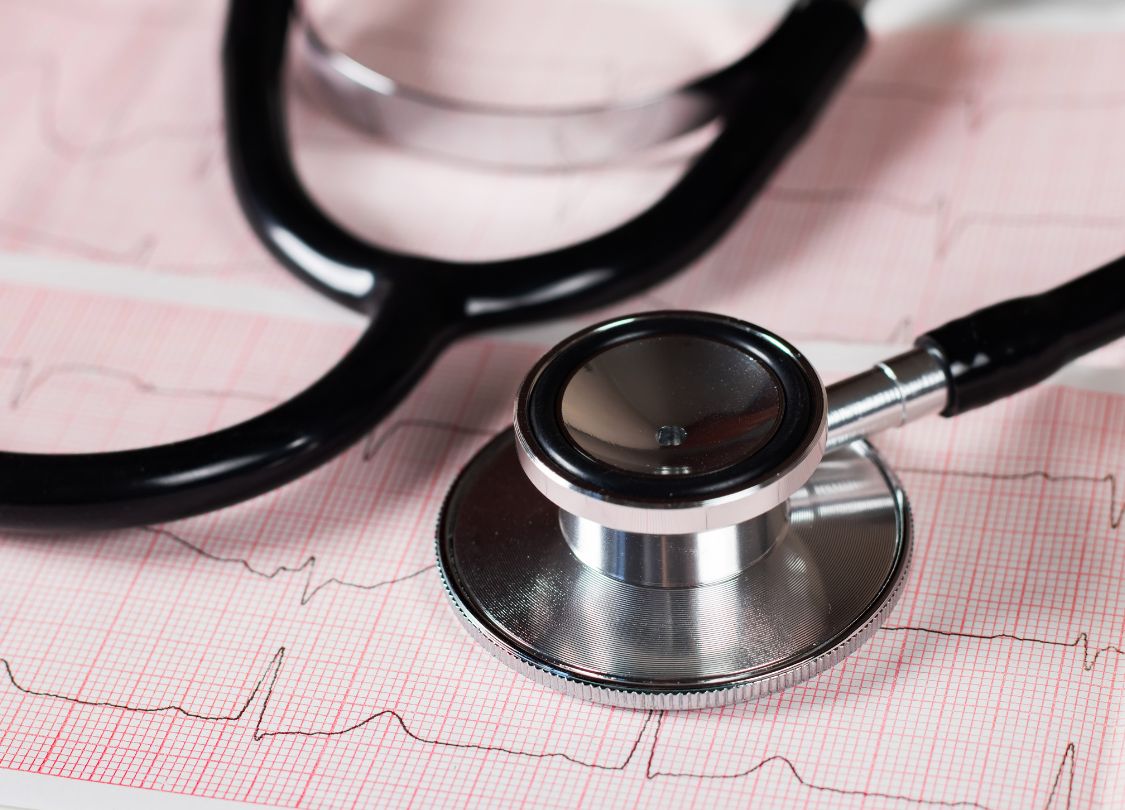 Close-up of a stethoscope on an ECG printout demonstrating ACLS Algorithms for heart health monitoring.