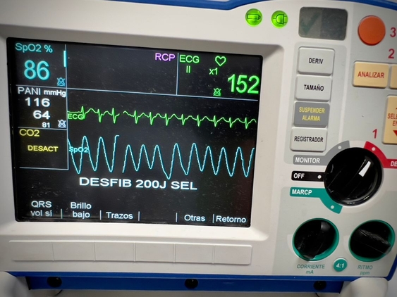 electrocardiogram defibrillator monitoring machine